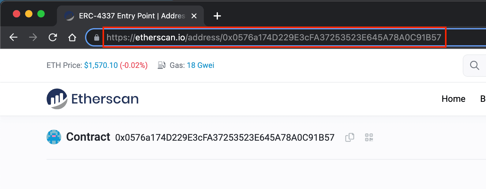Etherscan contract link screenshot